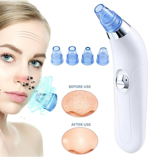 Blackhead Suction Remover & Pore Vacuum – Deep Pore Cleaner | Cell Operated Beauty Tool